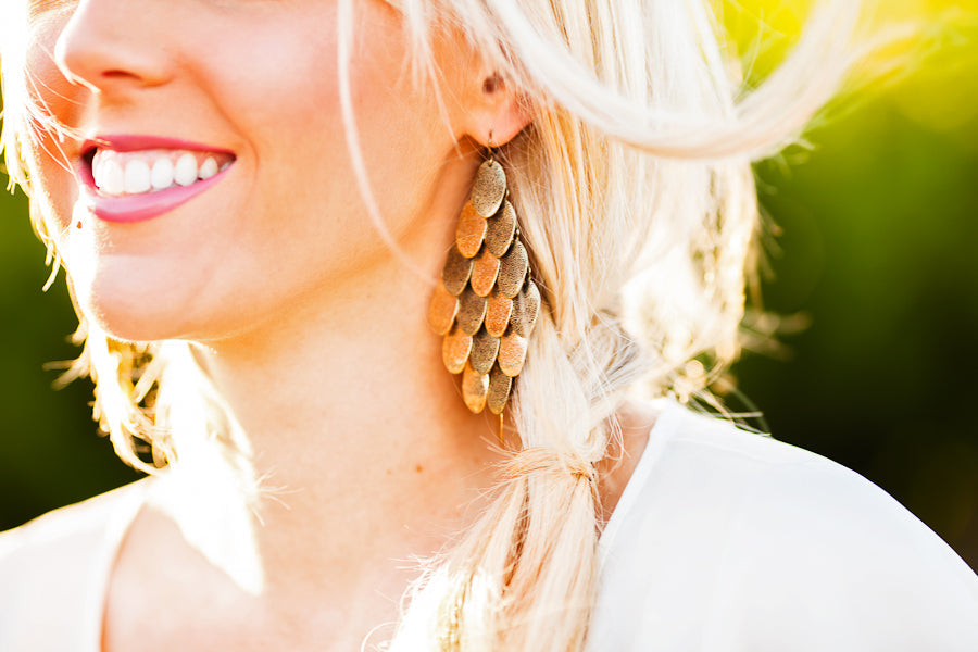 Accutane and Your Hair: How to Care for Dry, Shedding Hair on Isotretinoin